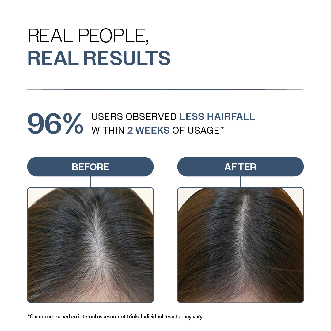 Hair Fall Control Shampoo with Peptides