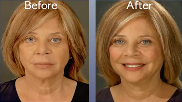 Art Harding Instant Face and Neck Lift