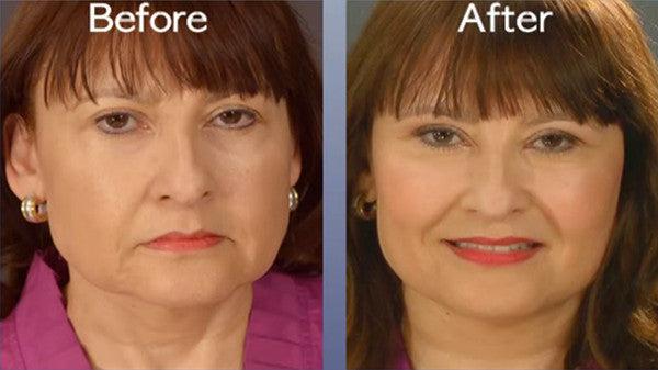 Art Harding Instant Face and Neck Lift