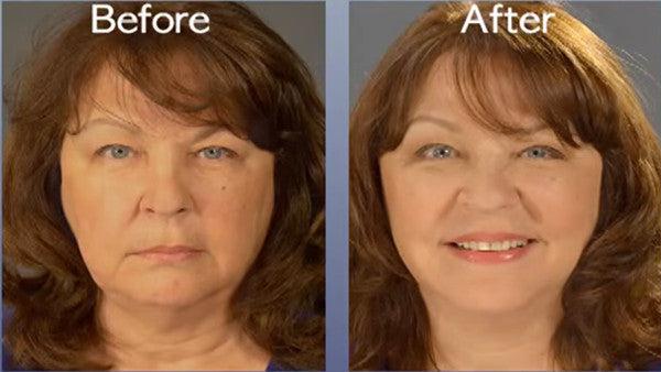 Art Harding Instant Face and Neck Lift