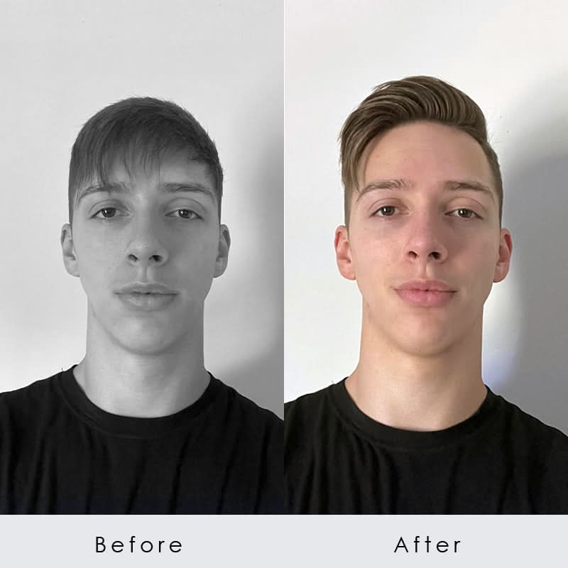 All Day Hold Kit for Flat Hair | Forte Series