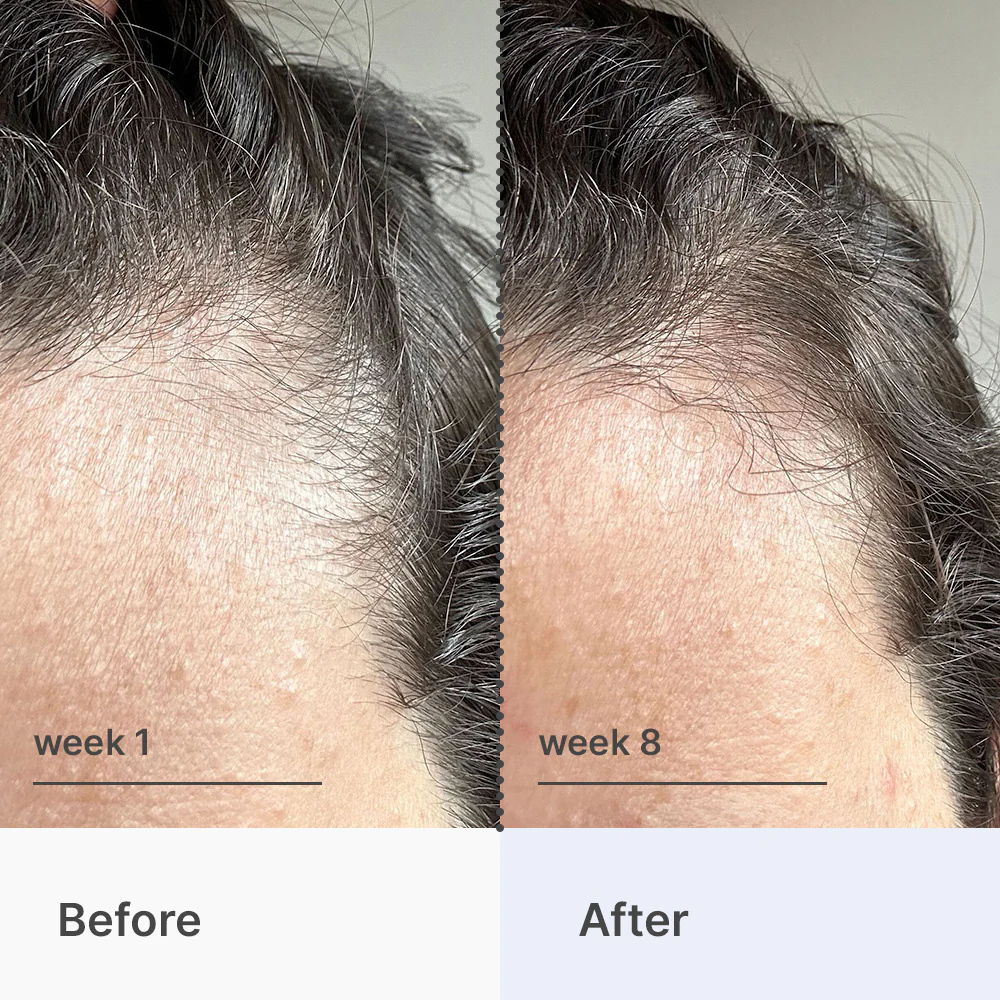 Superpower Fortifying Hair & Scalp Serum