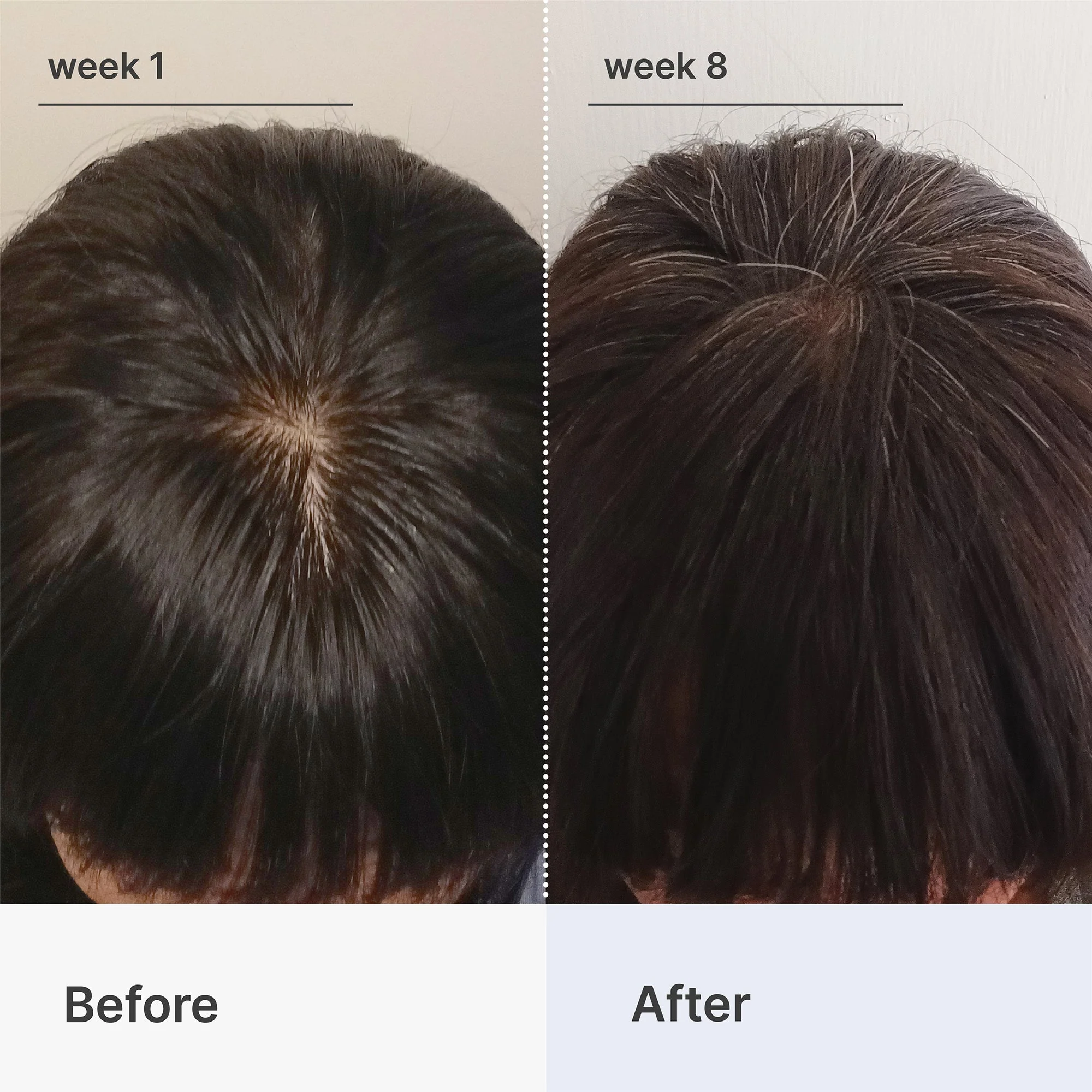 Hair Loss Starter Bundle